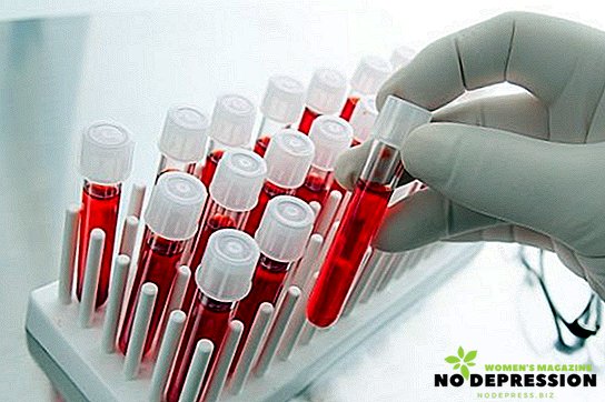 Bloedbiochemie: de norm en interpretatie van tests