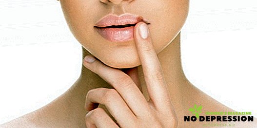 כיצד לטפל הרפס על השפתיים במהלך ההריון