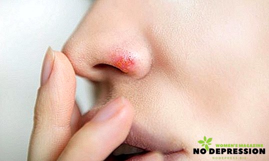 Co může rychle léčit nachlazení v nose?
