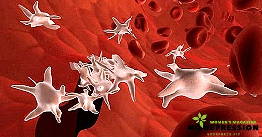 Ką daryti su padidėjusiais trombocitais kraujyje