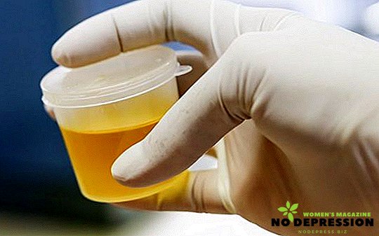 Mis on lima esinemine uriinis: analüüsi analüüs koos selgitustega