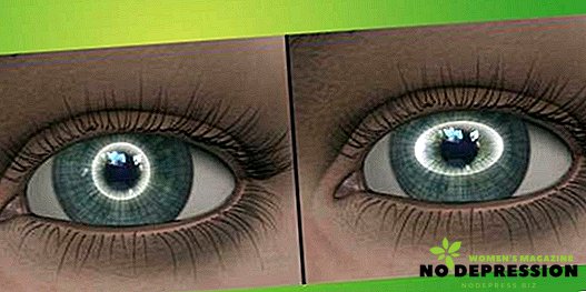 Kaj je očesni astigmatizem, kako zdraviti bolezen