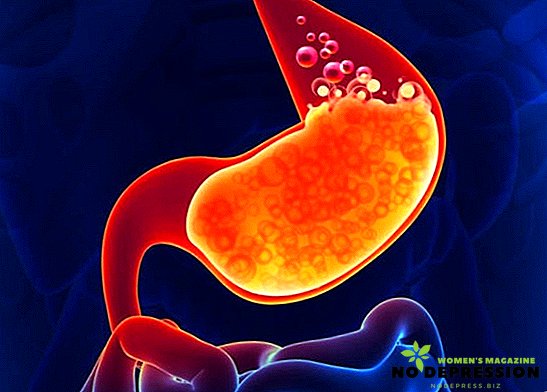 Hvad er overfladisk gastritis: symptomer og behandling