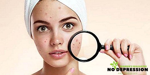 Effektive hjemmelavede acne ansigtsmasker