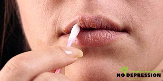 唇に風邪を取り除くための効果的な軟膏
