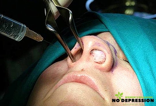 Curvatura del setto nasale: cause, fasi dell'operazione, complicanze