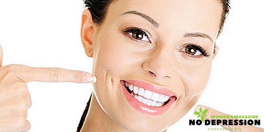 Hogyan kell biztonságosan fehéríteni a fogait otthon