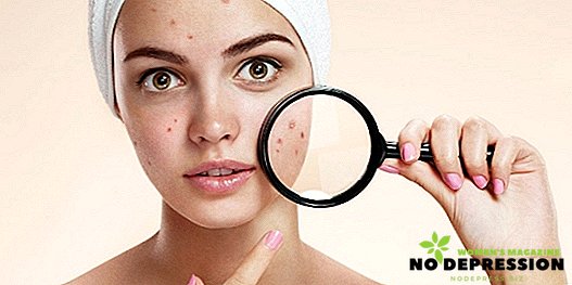 Hoe effectief en snel rode vlekken na acne te verwijderen