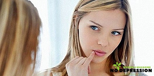 होंठ पर दाद का इलाज कैसे करें: दवा मलहम, लोक उपचार, डॉक्टर की सलाह