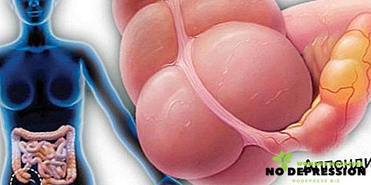 Come determinare i sintomi dell'appendicite negli uomini