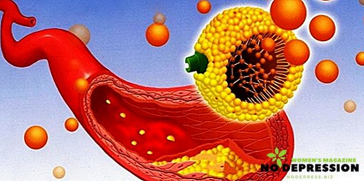 Cara menurunkan kolesterol dalam darah di rumah