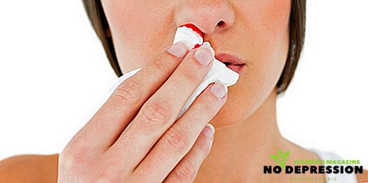 Як правильно зупинити кров з носа у дитини і дорослої людини