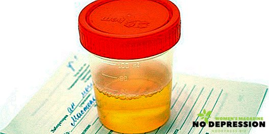 Hvordan passere og dechifisere den generelle analysen av urin hos voksne