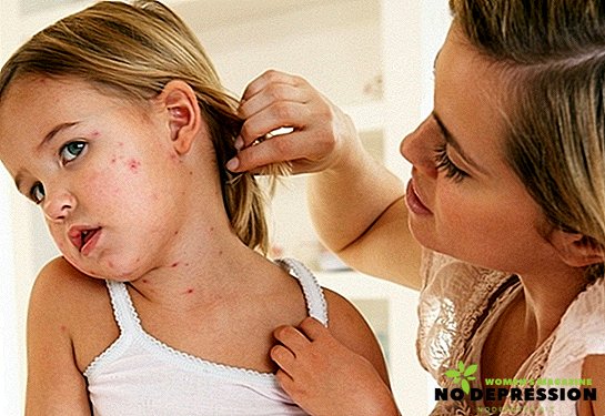 How is rubella manifested and treated in children
