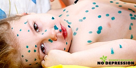 Jak se plané neštovice projevují u dětí v raném stádiu