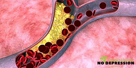 Hvilket niveau af kolesterol i blodet betragtes som normalt