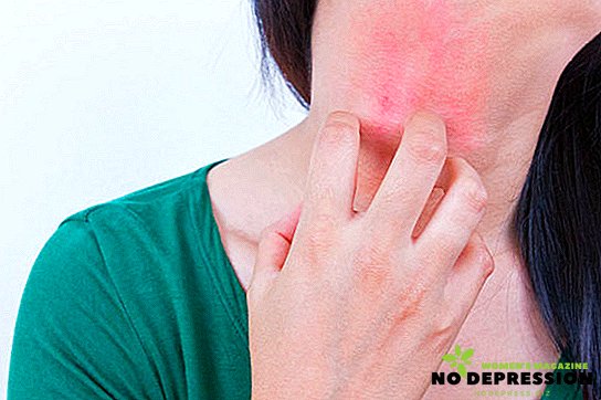 가려운 피부의 주요 원인 및 치료