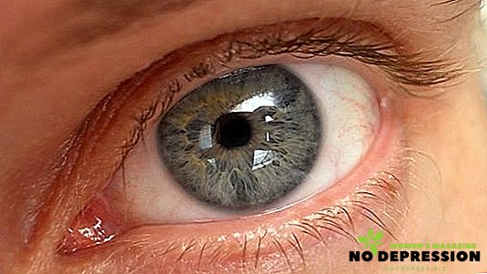ม่านตาออก - สาเหตุและการรักษา