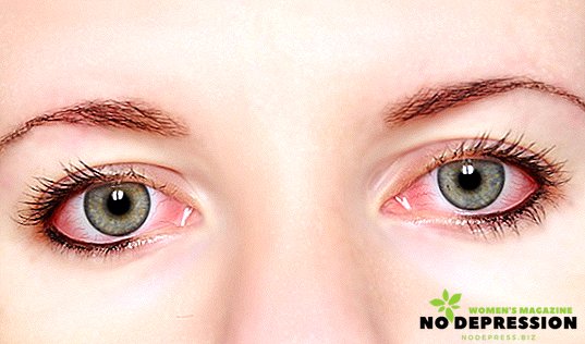 Miksi lapsen tai aikuisen silmät punastuvat, mitä voidaan tehdä