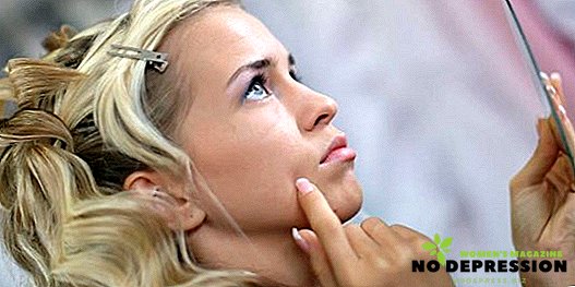 Hvorfor vises acne på kvindens kinder, hvordan man behandler dem ordentligt