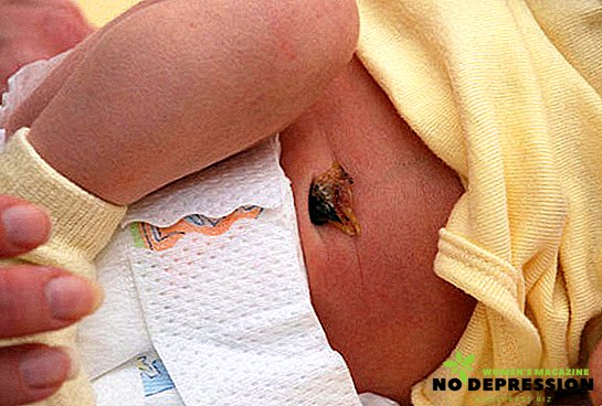 Tratamento adequado do umbigo em um bebê recém-nascido