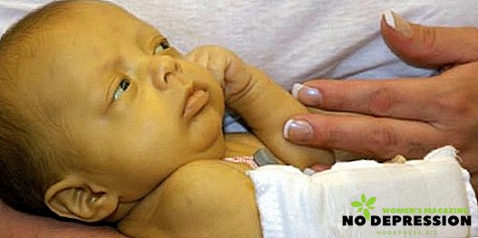 Årsaker, behandling og effekter av økt bilirubin hos nyfødte