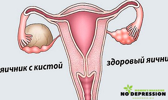 左右の卵巣における黄体嚢胞の原因と治療