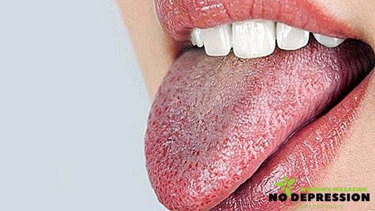 Orsaker och metoder för att eliminera torr mun
