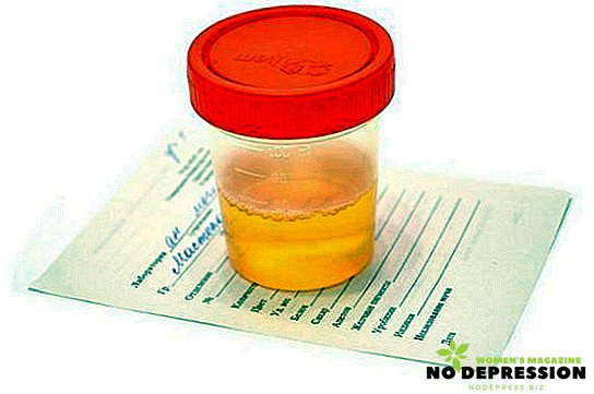 Årsager til flade epithel i urinen