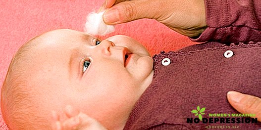 Príčiny akné na tvári novorodencov