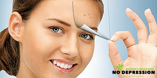 Akne na čelu kod žena: uzroci i metode liječenja