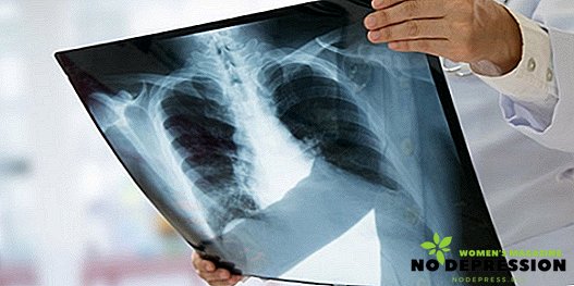 Felnőtt tüdőgyulladás jelei és a kezelés jellemzői