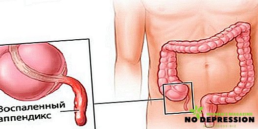 Jak je v člověku apendicitida, jaká je bolest