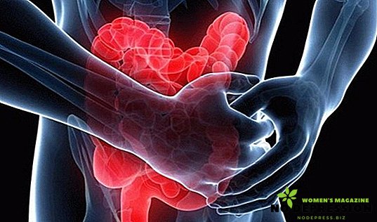 Symptome und Behandlung von Colitis ulcerosa