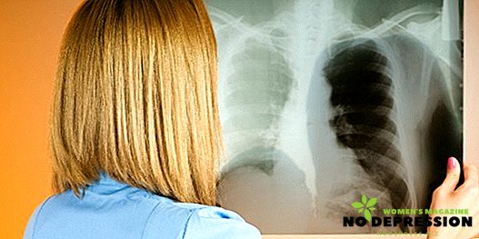 Tubercolosi negli adulti: sintomi, primi segni, metodi di trattamento