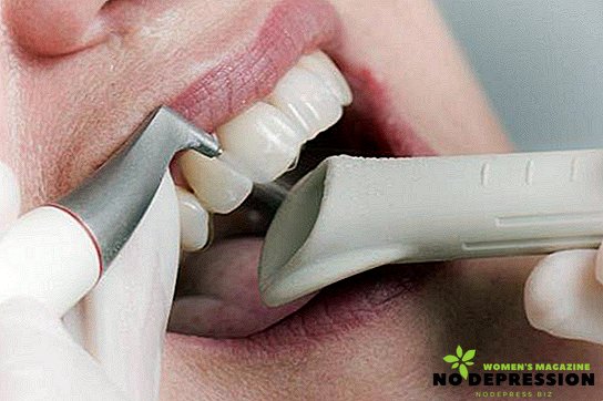 Ултразвуково почистване на зъбите: плюсове и минуси, последващи грижи