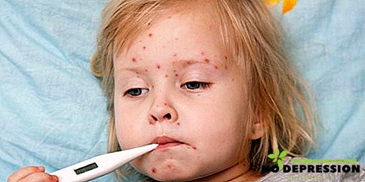 小児の水痘：症状、治療および予防措置